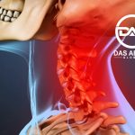5 CARA ATASI SAKIT TENGKUK AKIBAT SALAH BANTAL